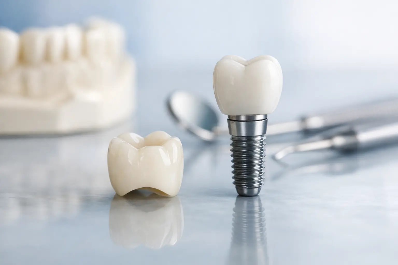 Krone oder Implantat - was passt zu Ihrem Zahn?